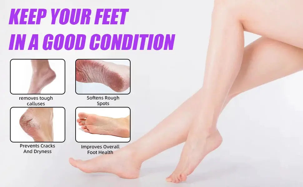 Simples Market USB rechargeable electric foot callus remover with 60 replacement sandpaper sheets for smooth feet.