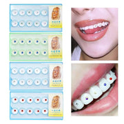 Tooth gem set, 10 crystal diamond ornaments with colorful stones for dental decoration by Simples Market