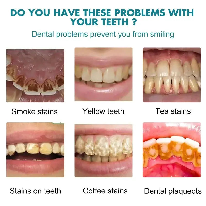 Simples Market Teeth White Paint oral care anti-pigmentation stain remover for smoke, tea, coffee stains 6 stain types