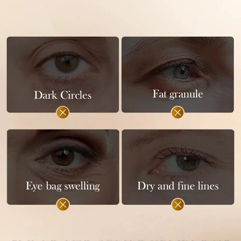 Sadoer Snake Venom Peptide Caffeine Massaging Eye Cream For Anti Wrinkle Dark Circles Anti Aging Moisturizing Skin Care