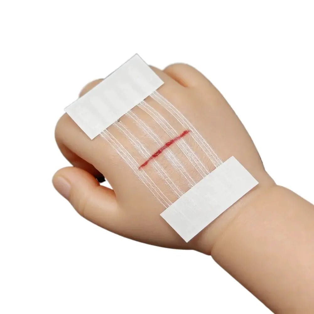 5 Wound Closure Strips For Postpartum Wound Repair Suture Free Medical Adhesive Tape For Cosmetic Surgery