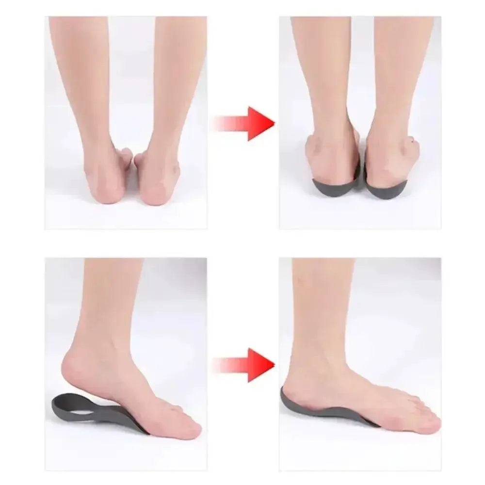 Orthotic Insoles For Flat Feet O Shaped Legs And Plantar Fasciitis Unisex Arch Support Shoe Inserts 1 Pair