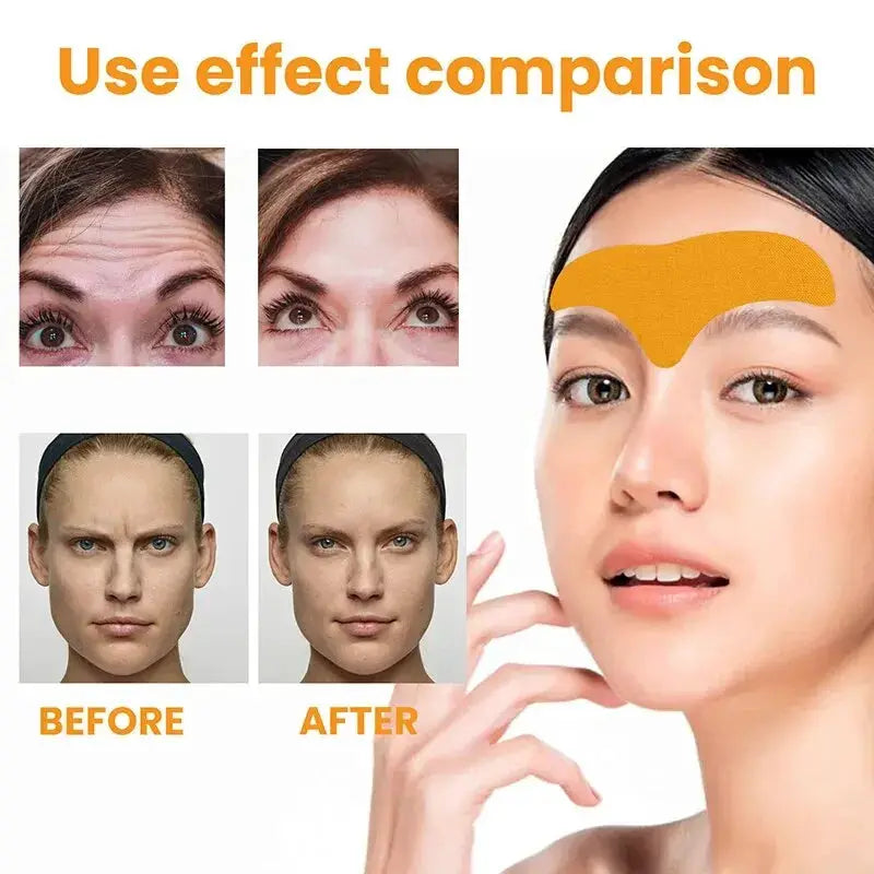EverGlow Forehead Wrinkle Patch Lifts And Tightens Skin Smoothing Fine Lines With Collagen And Botanicals