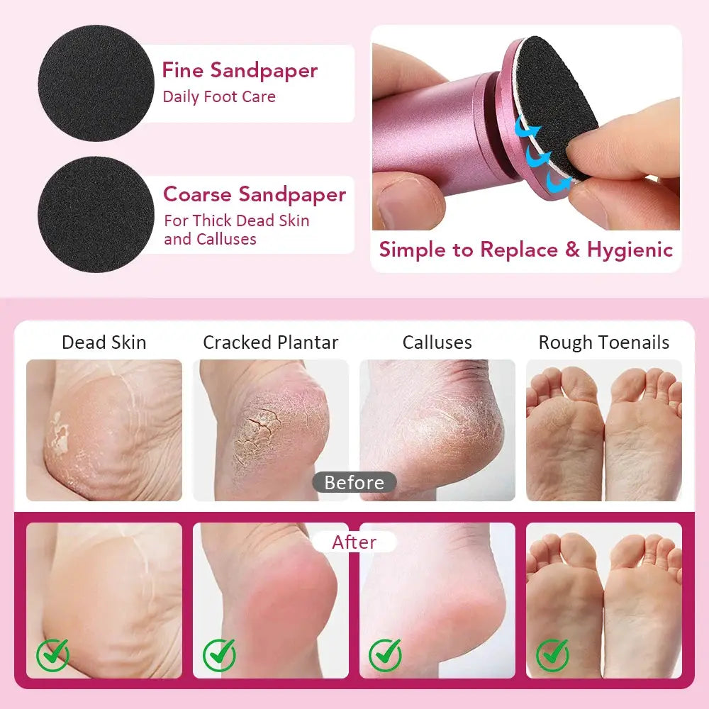 Electric foot callus remover by Simples Market, pink with 2 replaceable black discs (fine & coarse) for heels.