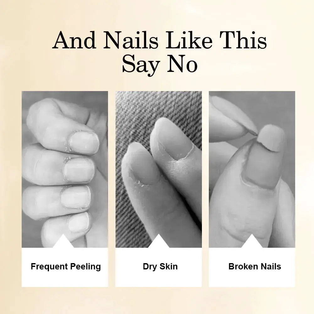 NailCare Pro Nail Nutrition Oil Pen Six Scents For Cuticle Repair And Hydration For Healthier Nails