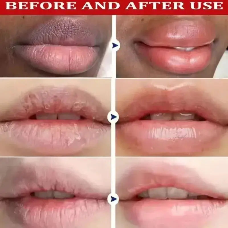 Fast Lighten Melanin Lip Mask For Dark Lips Exfoliating Fade Lip Lines Nourishing Lip Care Serum