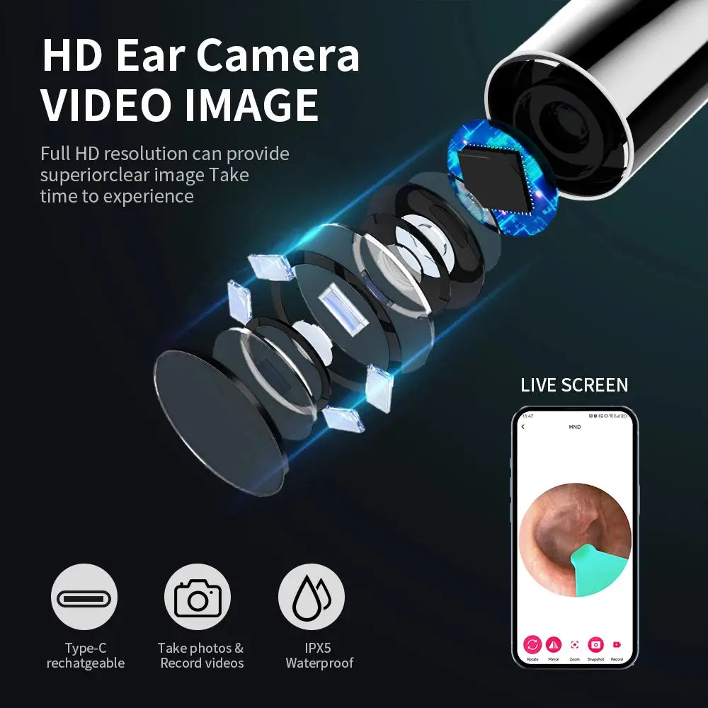 NK3 Pro Ear Cleaner With Camera Set 1296P HD Camera 360 Degree Wide Angle Lens For Precise Wax Removal