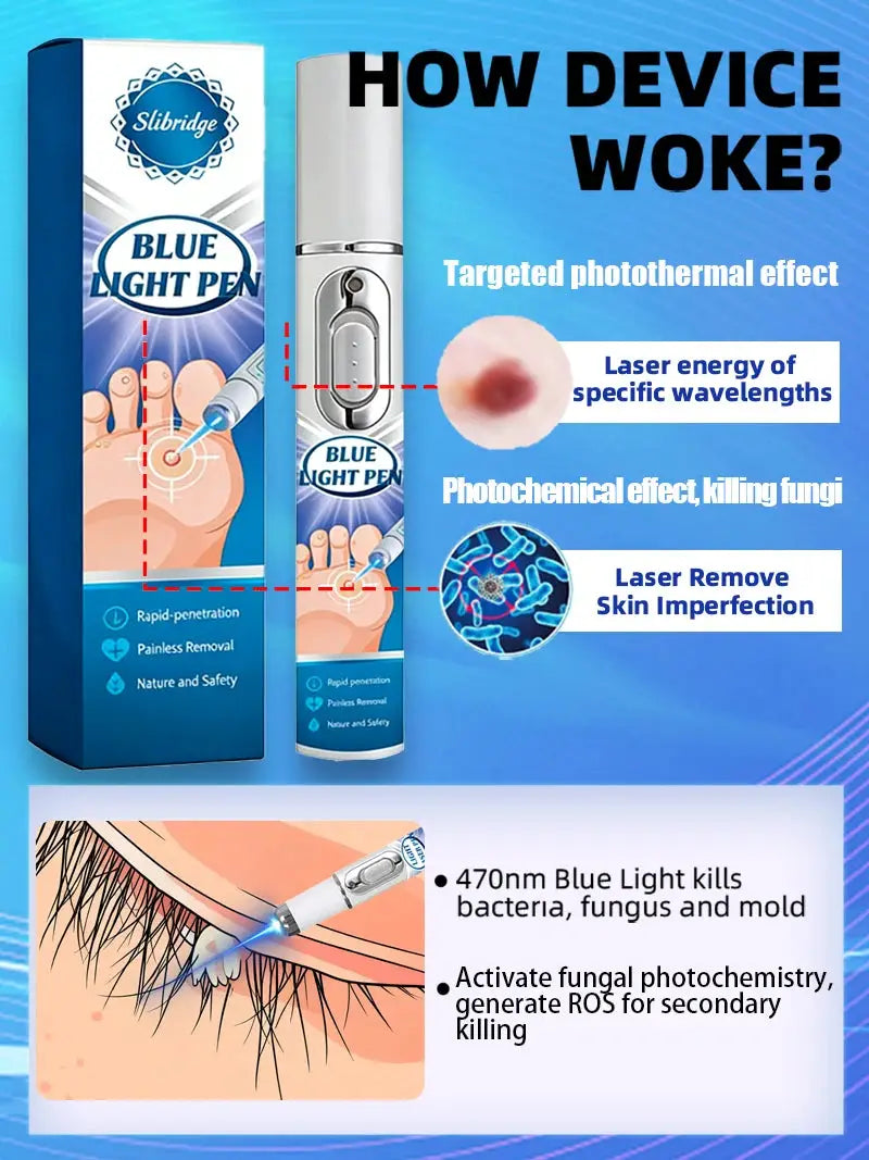Blue Light Wart Pen For Neck Warts Non Electric Wart Care Tool Safe At Home For Easy Home Use
