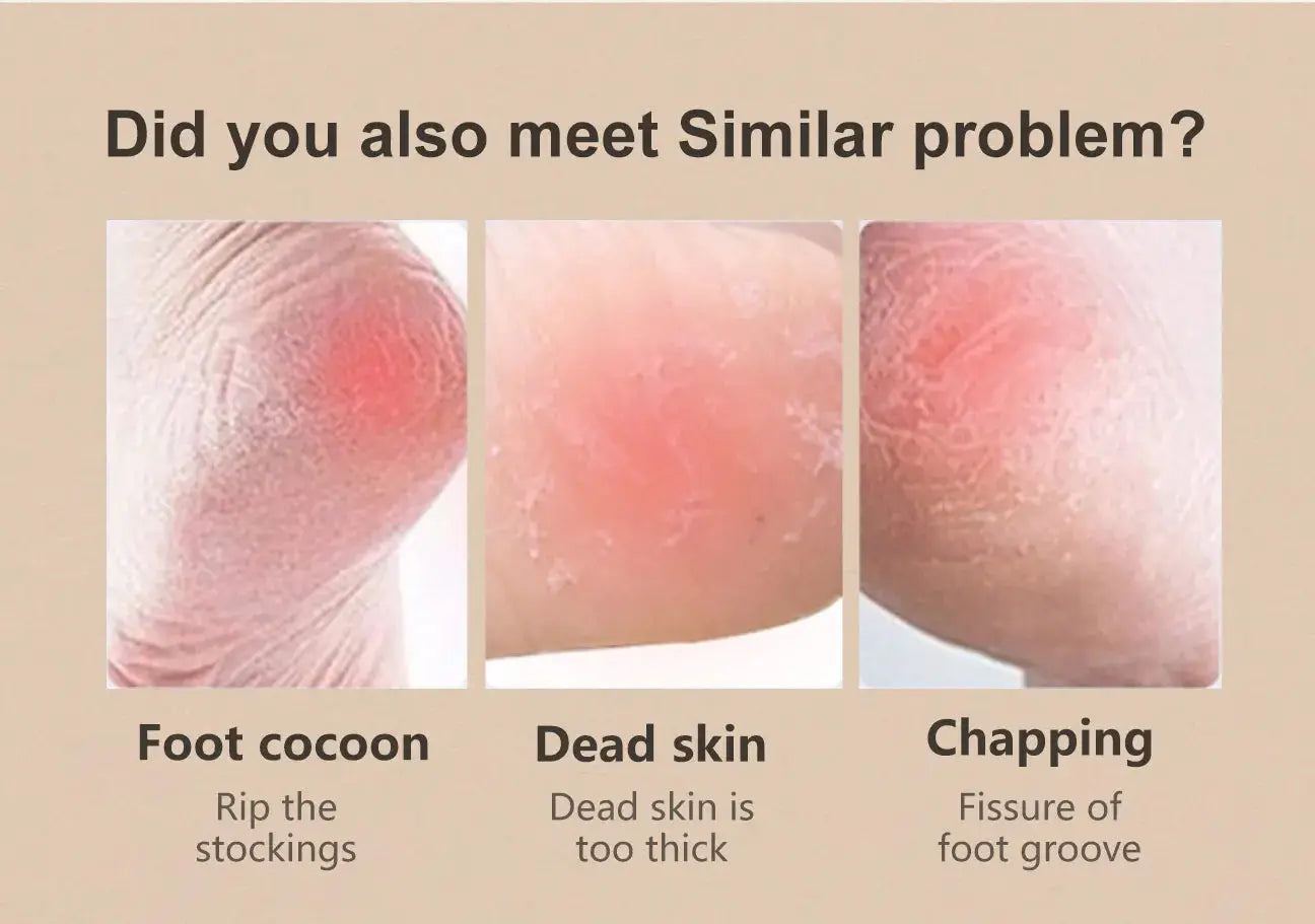 Foot care infographic showing three foot problems: foot cocoon, dead skin, chapping