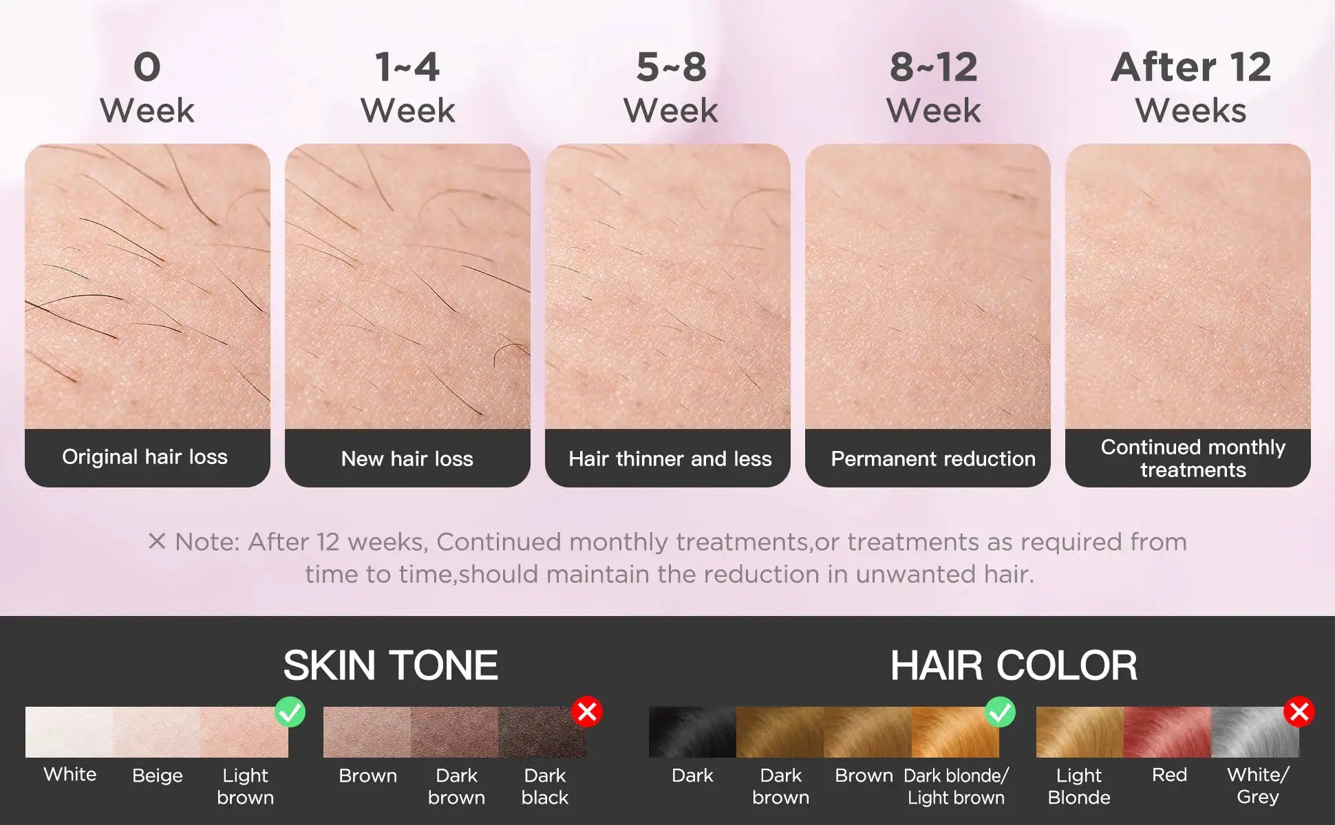 INNZA IPL hair remover device with ice cooling function by Simples Market; week-by-week hair reduction chart.