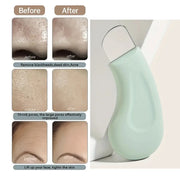 Blackhead and Whitehead Removal Tool for Nose and Face Skin Pore Cleaner Skin Care Tools for Women