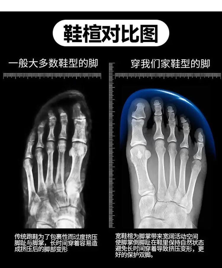 Men's breathable casual sneakers by Simples Market; X-ray foot comparison panels show standard vs our shoe last (right)