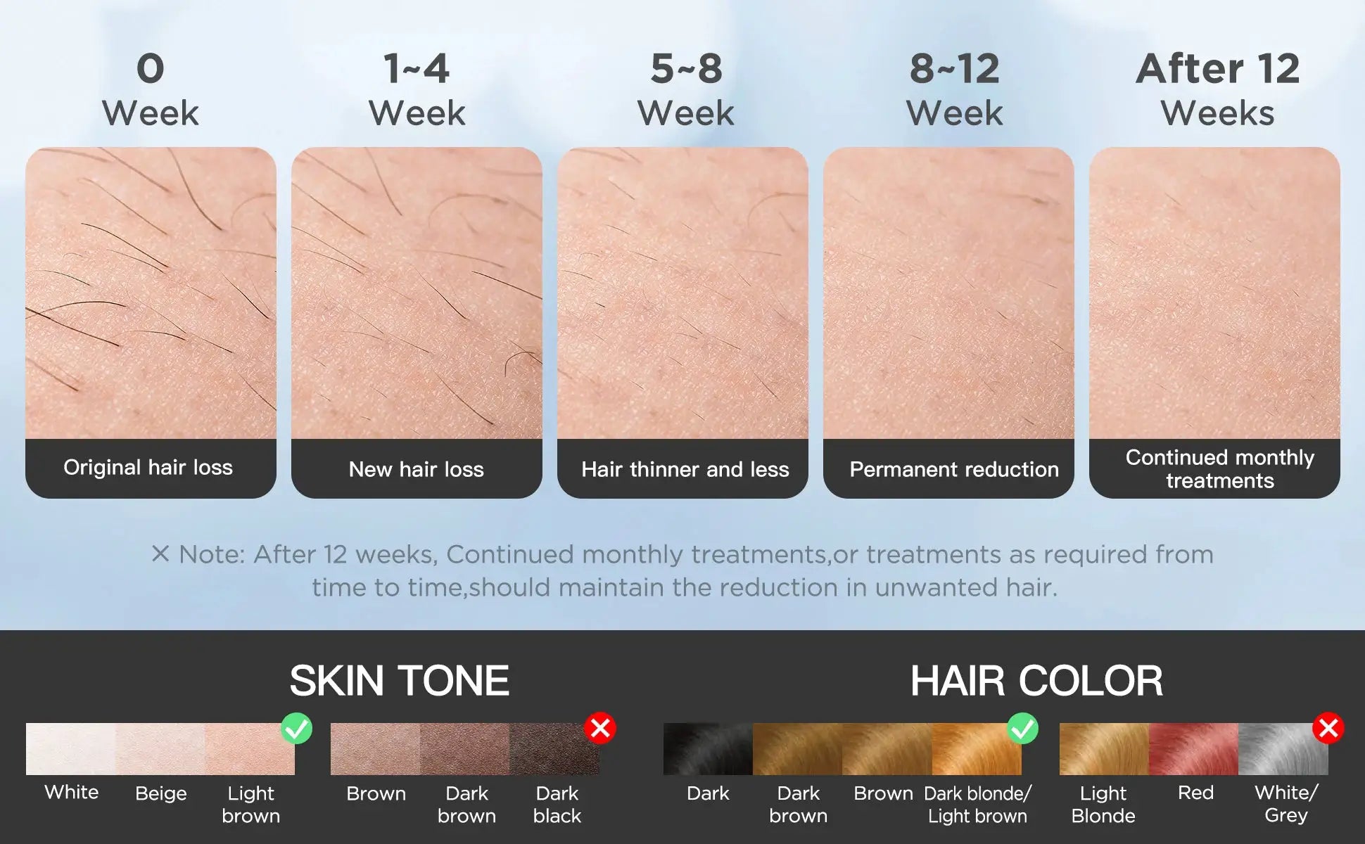INNZA IPL hair remover infographic by Simples Market showing 0–12 week progress and skin tone and hair color swatches.