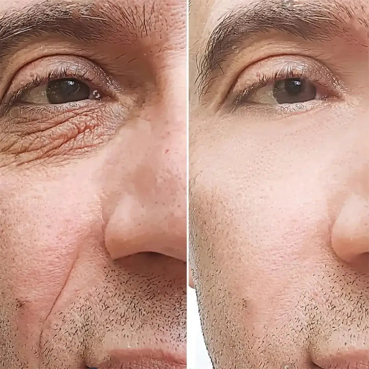 Retinol Anti Wrinkle Cream For Men With Collagen Hyaluronic Acid Moisturizing Firming Face And Neck Korean Skincare