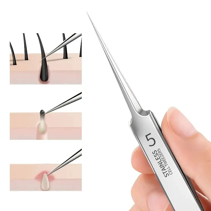 1 Pack Extra Fine No 5 Cellular Acne Blackhead Tweezers For Facial Beauty And Skin Care Tools