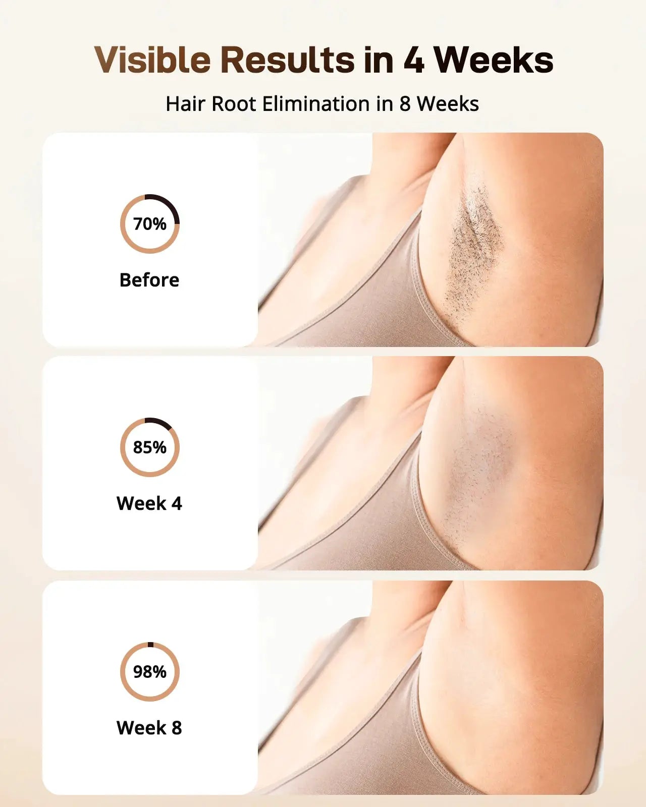 Simples Market IPL hair removal device with ice-cooling; 3-in-1 painless treatment; 3 panels show underarm results