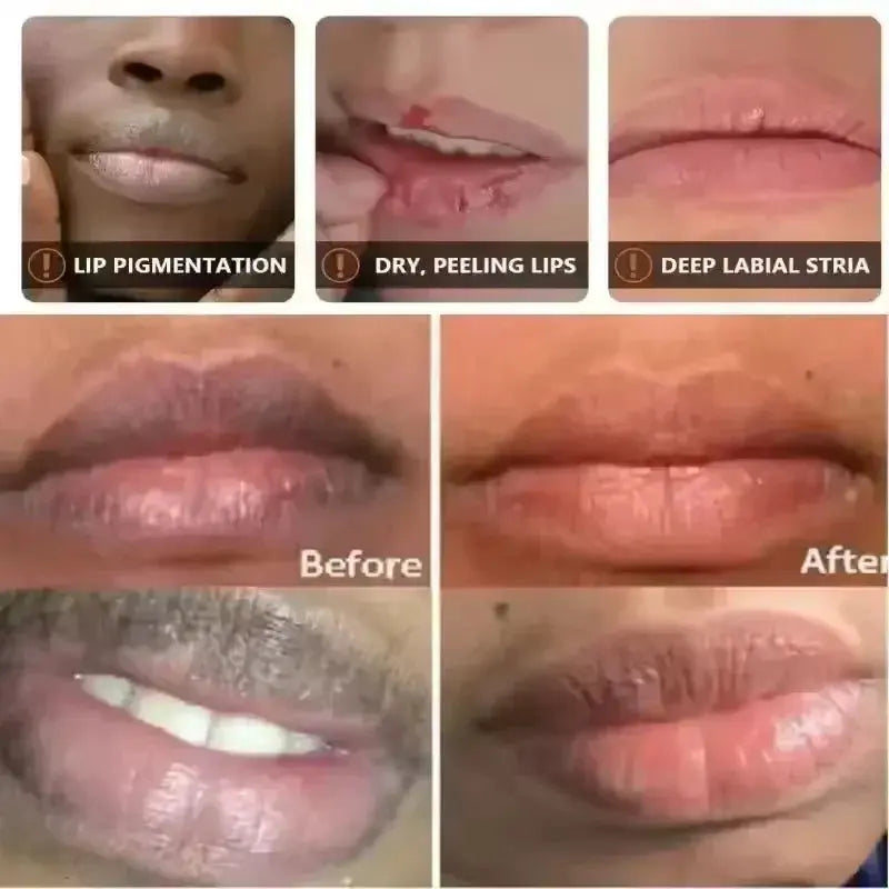 Fast Lighten Melanin Lip Mask For Dark Lips Exfoliating Fade Lip Lines Nourishing Lip Care Serum