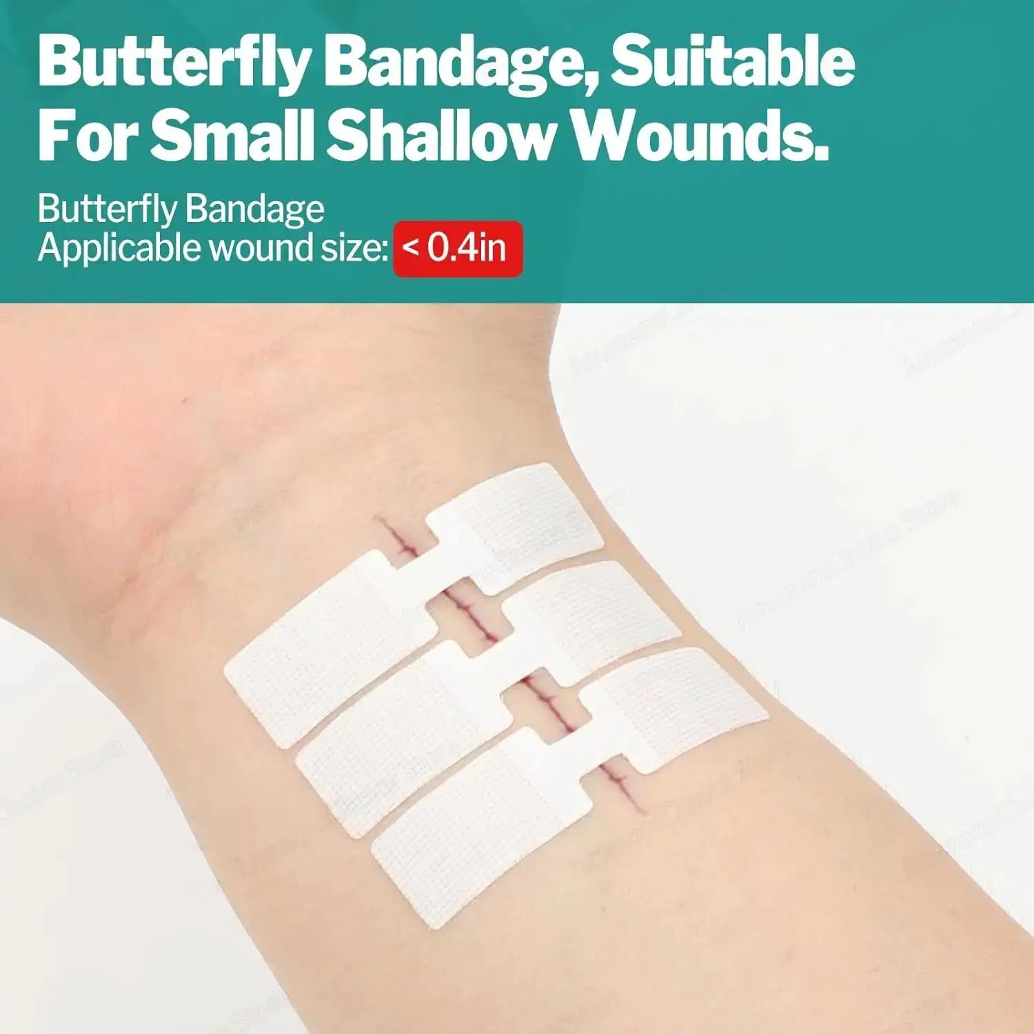 Sanke Rescue Wound Closure Strips Zipper Bandages Emergency Laceration Repair For First Aid Kit IFAK 1 14 28 Pack