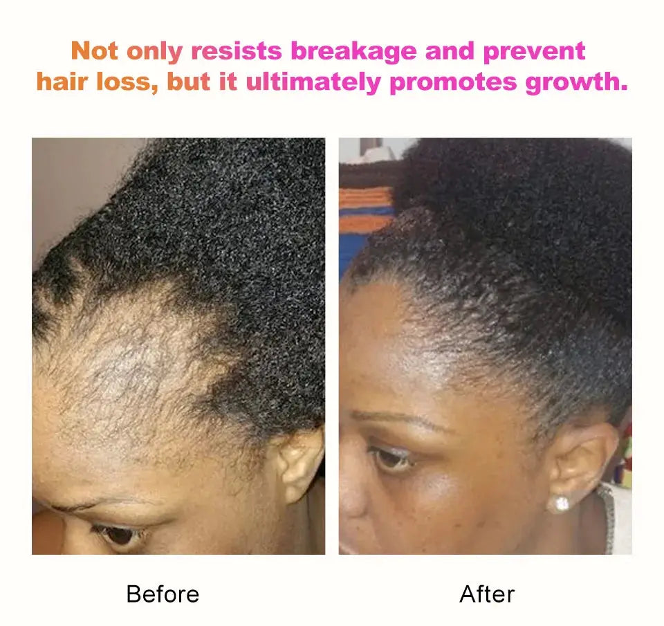 100% Natural Chebe Powder Natural Ingredients Promotes Hair Strengthens & Thickens Anti Hair Loss Hair Regrowth Treatment