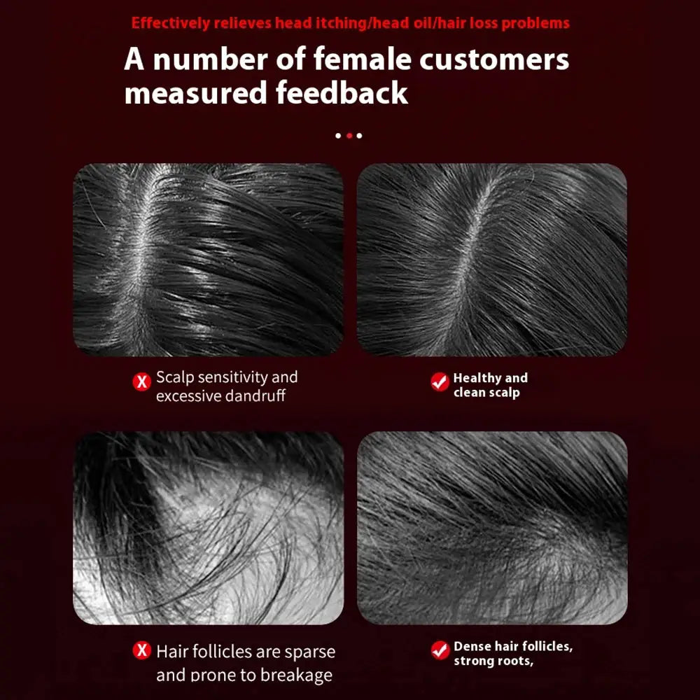 Electric head massager hair growth comb by Simples Market with 630nm red light and oil applicator