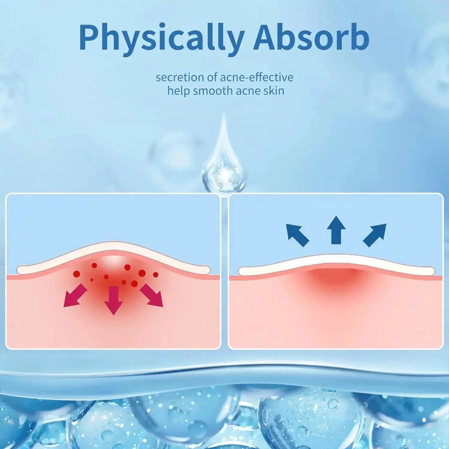 24 Hydrocolloid Acne Stickers Individually Packaged Daily Skincare Spot Covers Waterproof Oil Absorbing