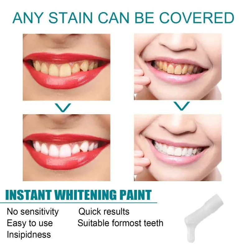 Simples Market Teeth Whitening Paint; instant whitening for stained teeth with quick results and before/after images.
