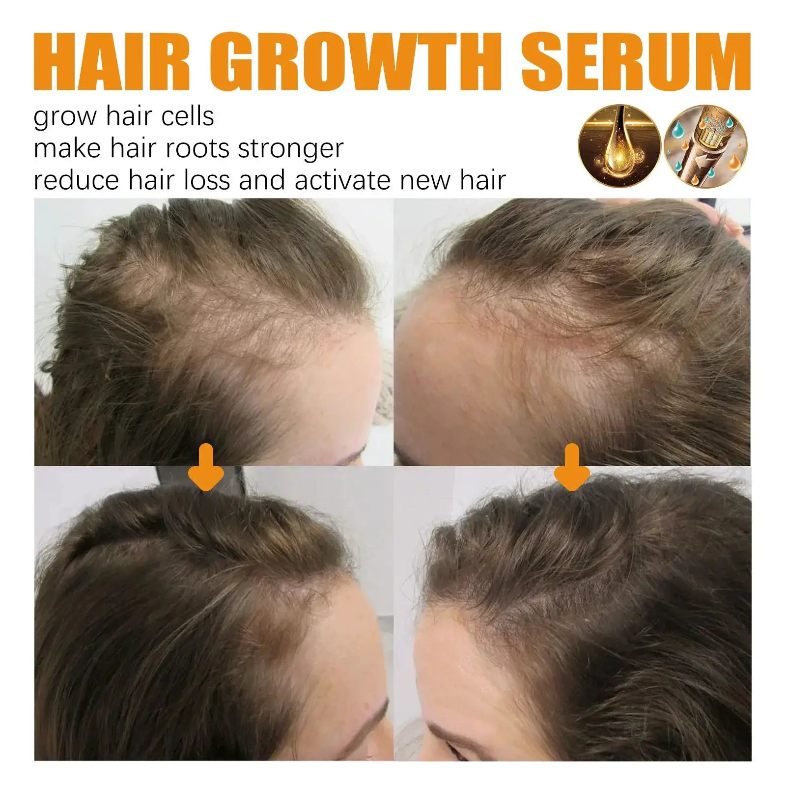 EELHOE Biotin Hair Spray For Man Women 30ml Hair Growth Repair Damage Restore Oil Scalp Repair Serum Spray Thicken Hair Care