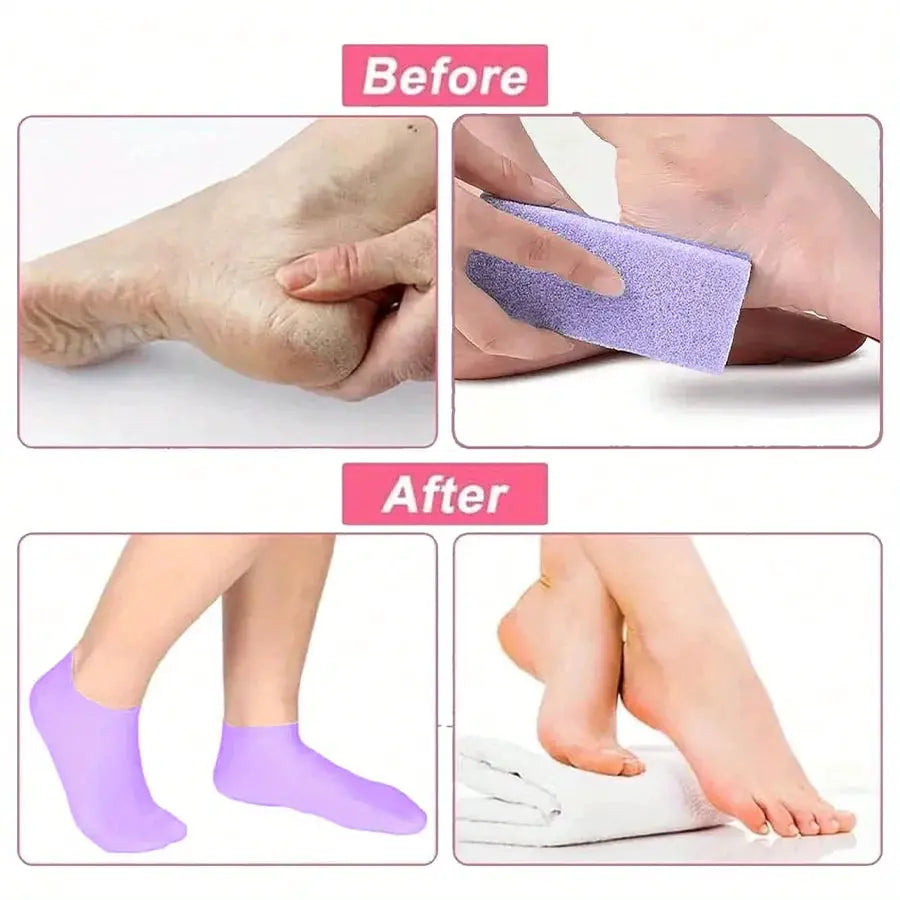Moisturizing Silicone Foot Socks For Women Dry Cracked Feet With Soothing Massage And Hydration