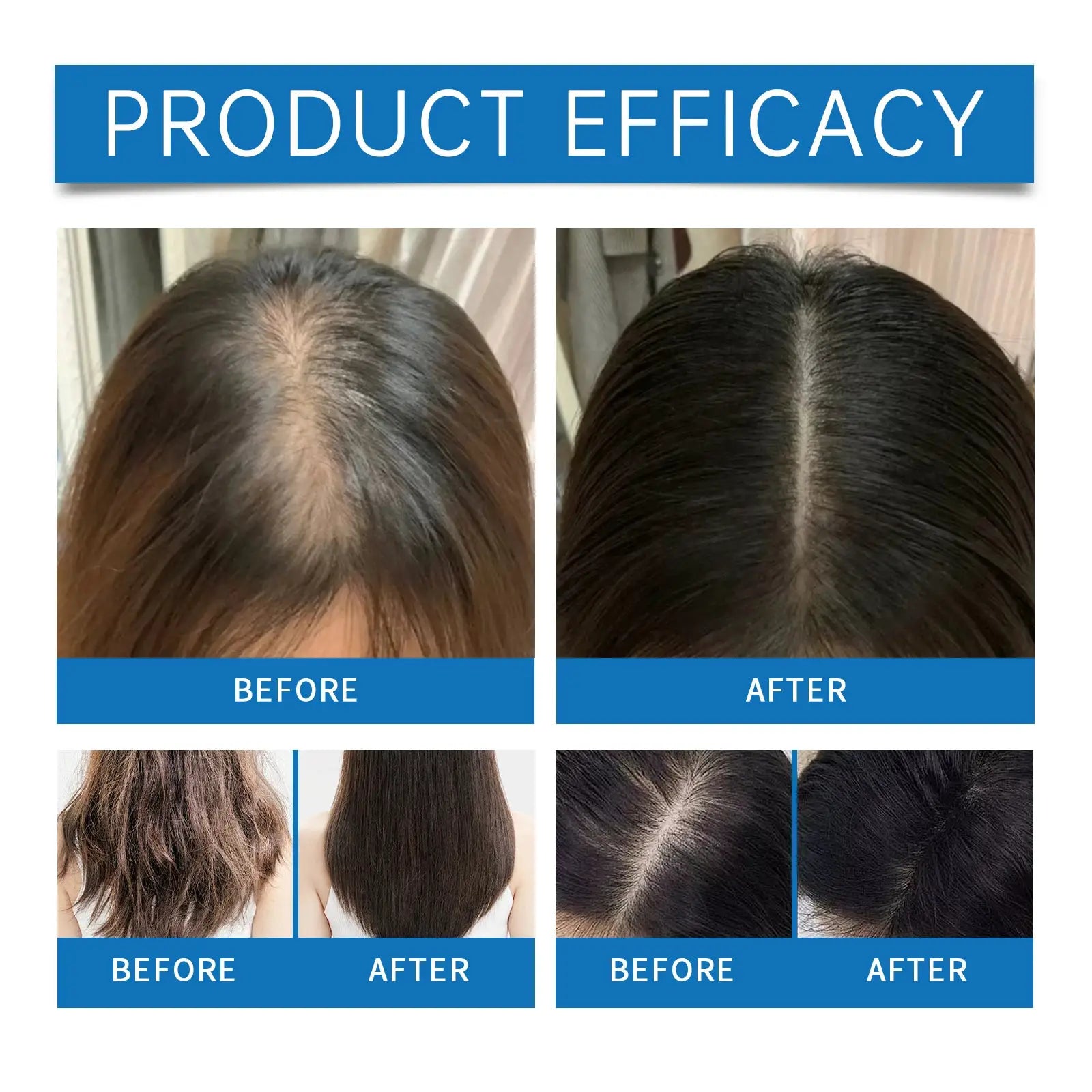 Rosemary Hair Nourishing Serum Roll-on Growth Roller Increase Hair Density Nourish Improves Scalp Health Hair Essence Care 25ml