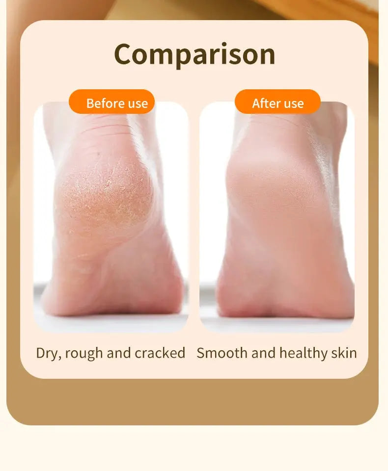 HOMEFISH electric foot grinder comparison: before dry, rough heel; after smooth, healthy skin — Simples Market