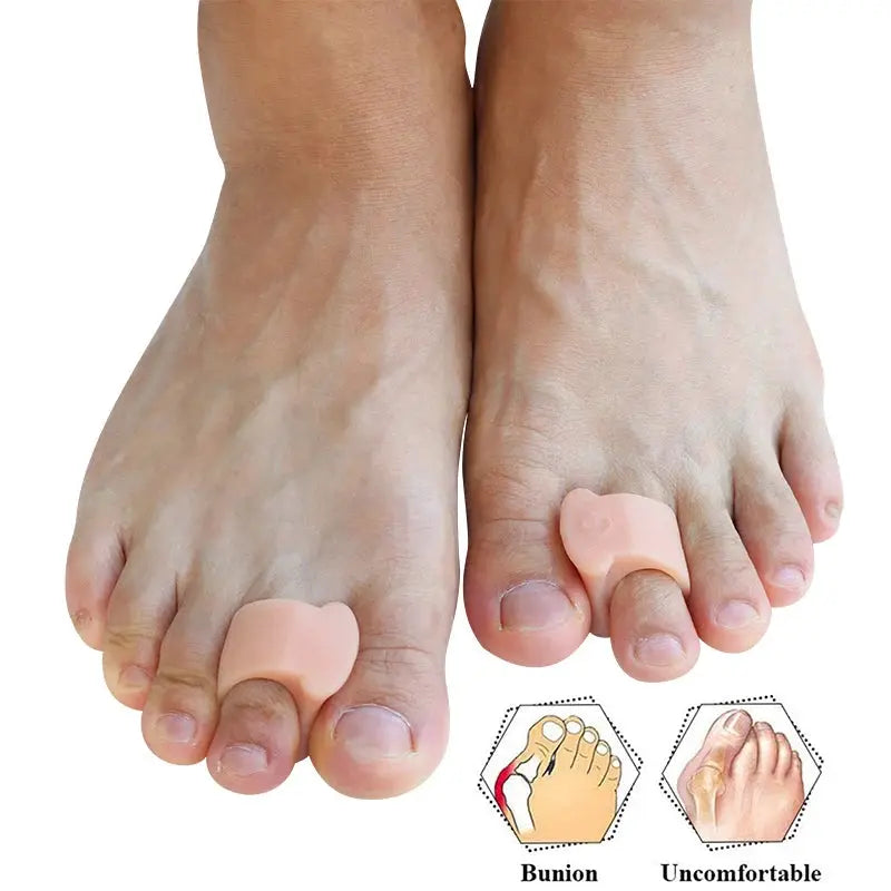Pexmen Soft Gel Toe Separators 2 4 10 Pcs Set For Bunions Hallux Valgus Hammertoe Relief Foot Care Tool