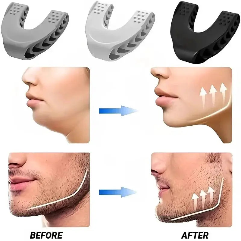 U Shape Jaw Exerciser For Men And Women Face Muscle Training Neck Toning And Jawline Resistance Levels Chin Reducer