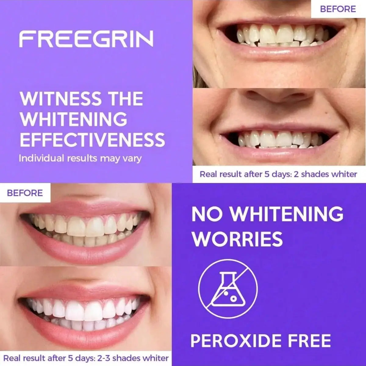 Deluxe Whitening Teeth Stickers by Simples Market; mint-flavored gel strips, peroxide-free, 4-panel collage before/after