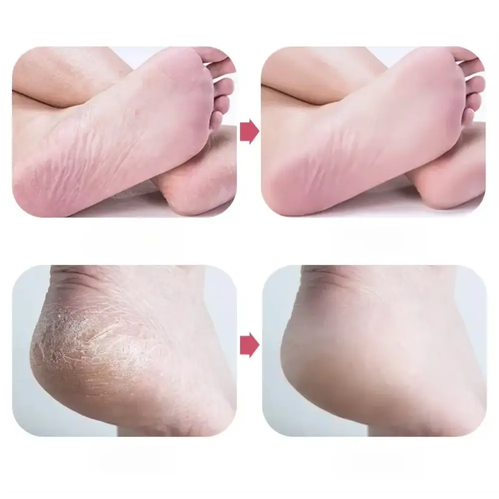 Nano Glass Foot File Callus Remover For Pedicure Exfoliating Stone For Dry And Wet Skin Heel Care