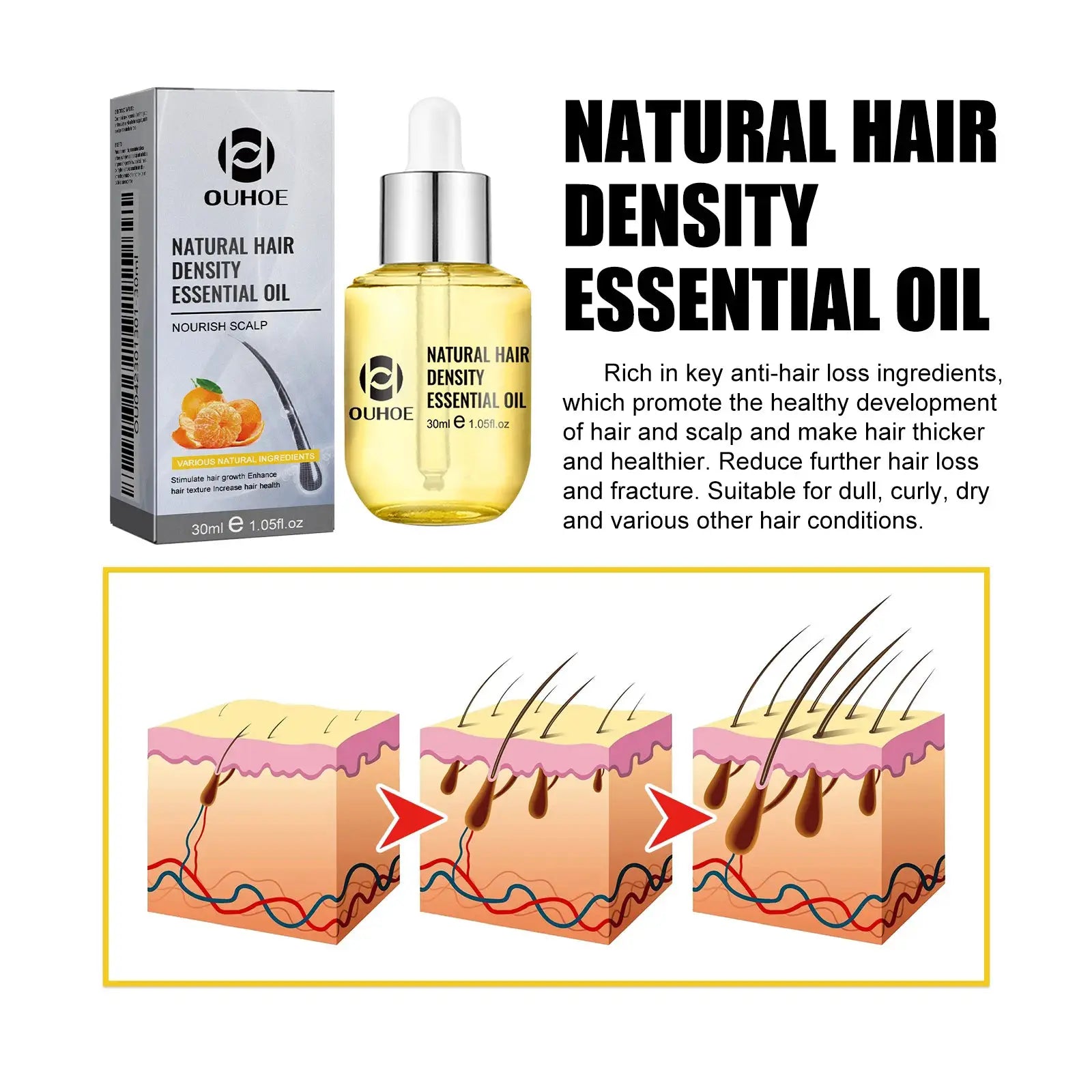 Ouhoe Hair Care Oil for Thinning Hair Scalp Treatment Serum to Strengthen Roots and Repair Damaged Hair 30ml Natural Formula