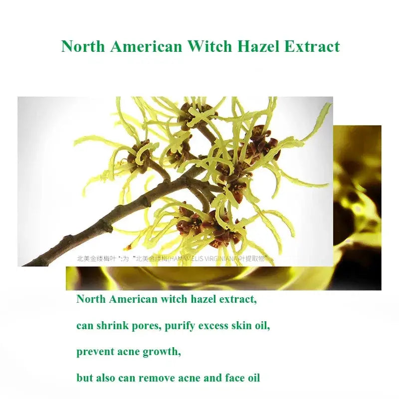 Herbal Acne Treatment Cream For Face Scar Repair Blackhead Removal Oil Control Pore Tightening Whitening Korean Cosmetics