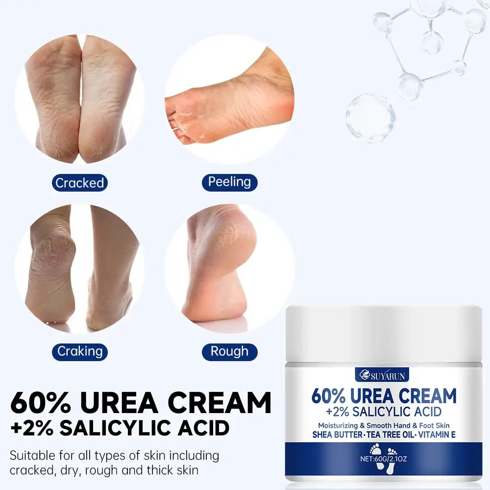 Suyarun 60 Percent Urea Foot Cream For Intense Moisturizing Treatment Cracked Heels And Dry Skin Callus Removal
