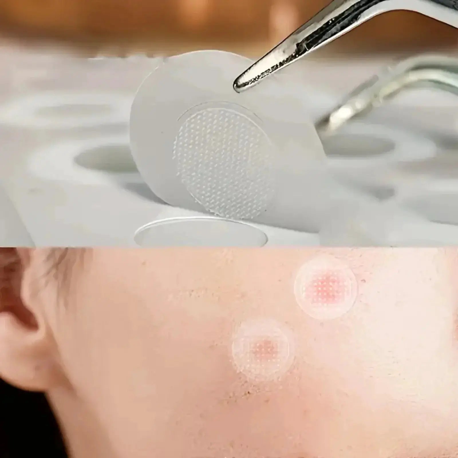 24 Hydrocolloid Acne Stickers Individually Packaged Daily Skincare Spot Covers Waterproof Oil Absorbing