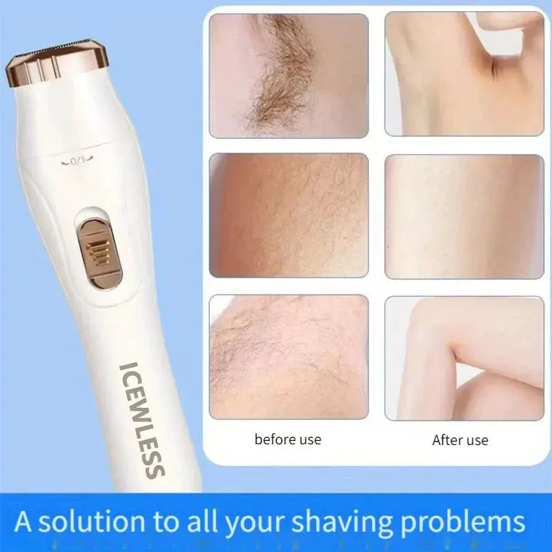 Simples Market electric women's body hair trimmer; white with rose-gold head, waterproof shaver for bikini/armpit/legs/face.
