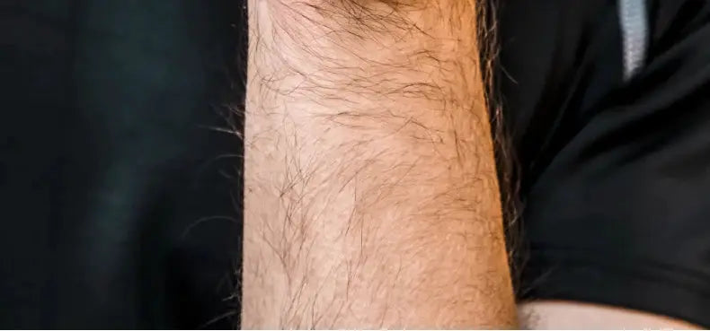 Close-up of a hairy forearm against a dark background with black fabric in view.