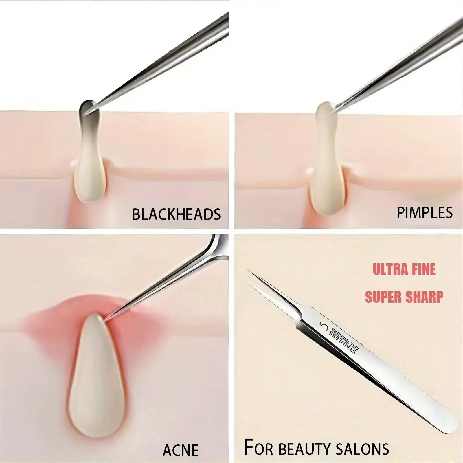 1 Pack Extra Fine No 5 Cellular Acne Blackhead Tweezers For Facial Beauty And Skin Care Tools