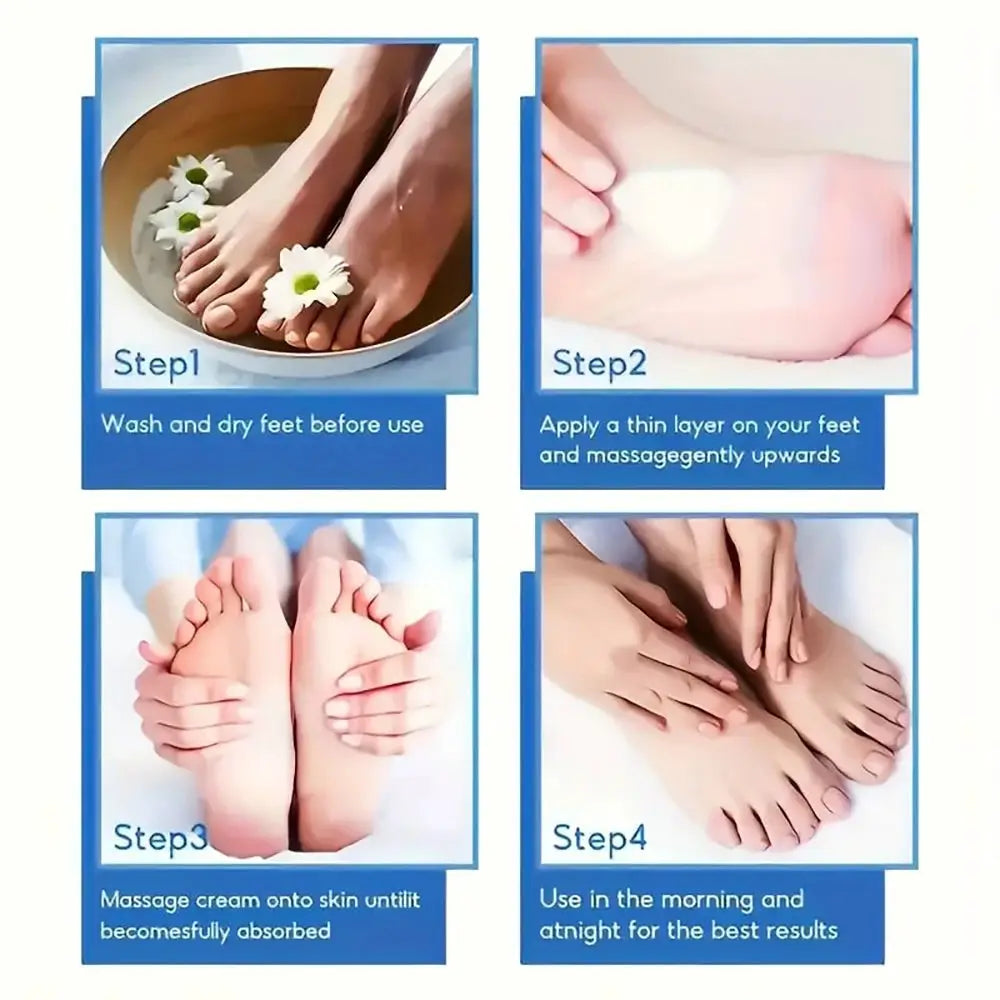 Suyarun 60 Percent Urea Foot Cream For Intense Moisturizing Treatment Cracked Heels And Dry Skin Callus Removal