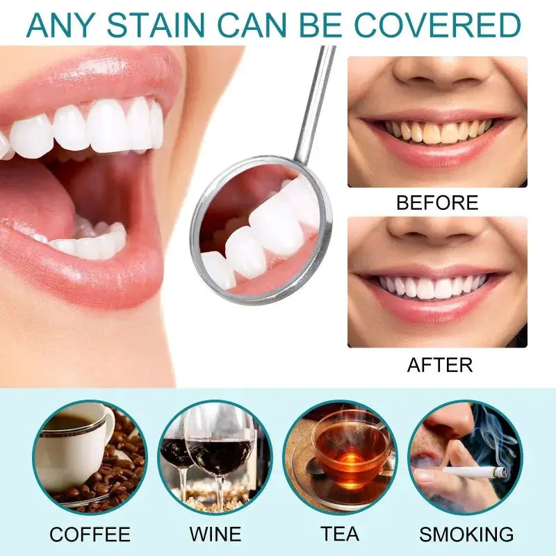 Teeth White Paint whitening by Simples Market; anti-pigmentation and smoke stain removal; before/after