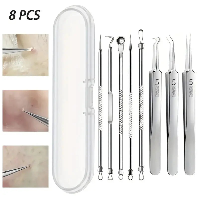 8 Piece Blackhead Remover Kit Stainless Steel Blemish Extraction Tools Professional Pimple Popper Set For All Skin