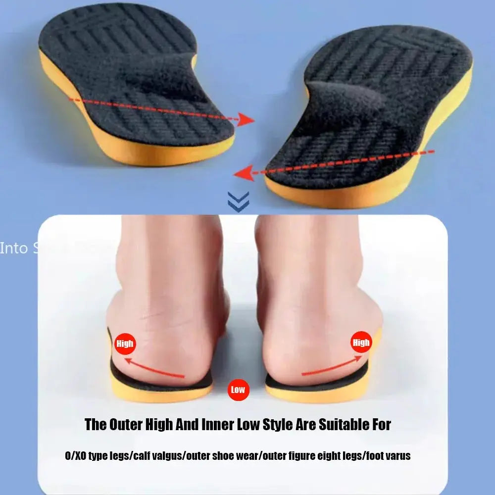 Arch Support Orthopedic Insoles For Flat Feet Women Men Children X And O Type Legs Valgus Feet Correction Shoes Pads