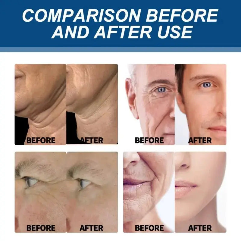 Retinol Anti Wrinkle Cream For Men With Collagen Hyaluronic Acid Moisturizing Firming Face And Neck Korean Skincare