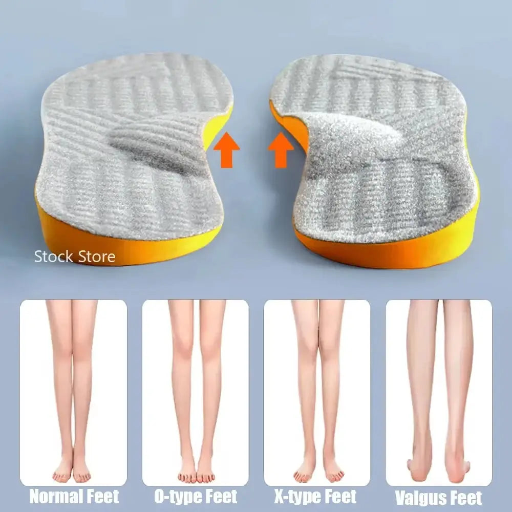 Arch Support Orthopedic Insoles For Flat Feet Women Men Children X And O Type Legs Valgus Feet Correction Shoes Pads