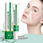 Herbal Acne Treatment Cream For Face Scar Repair Blackhead Removal Oil Control Pore Tightening Whitening Korean Cosmetics
