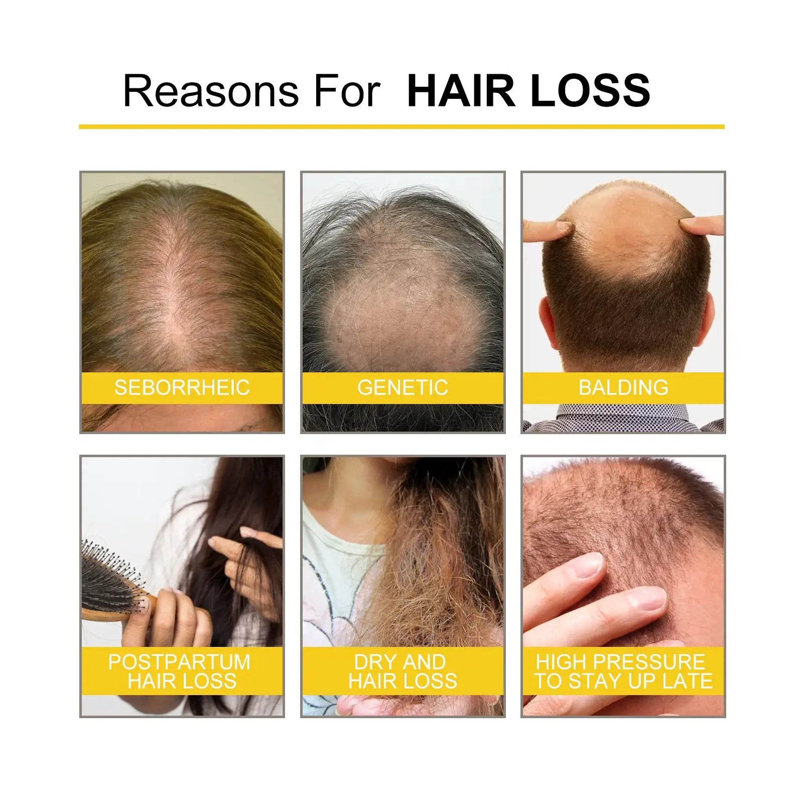Ouhoe Hair Care Oil for Thinning Hair Scalp Treatment Serum to Strengthen Roots and Repair Damaged Hair 30ml Natural Formula