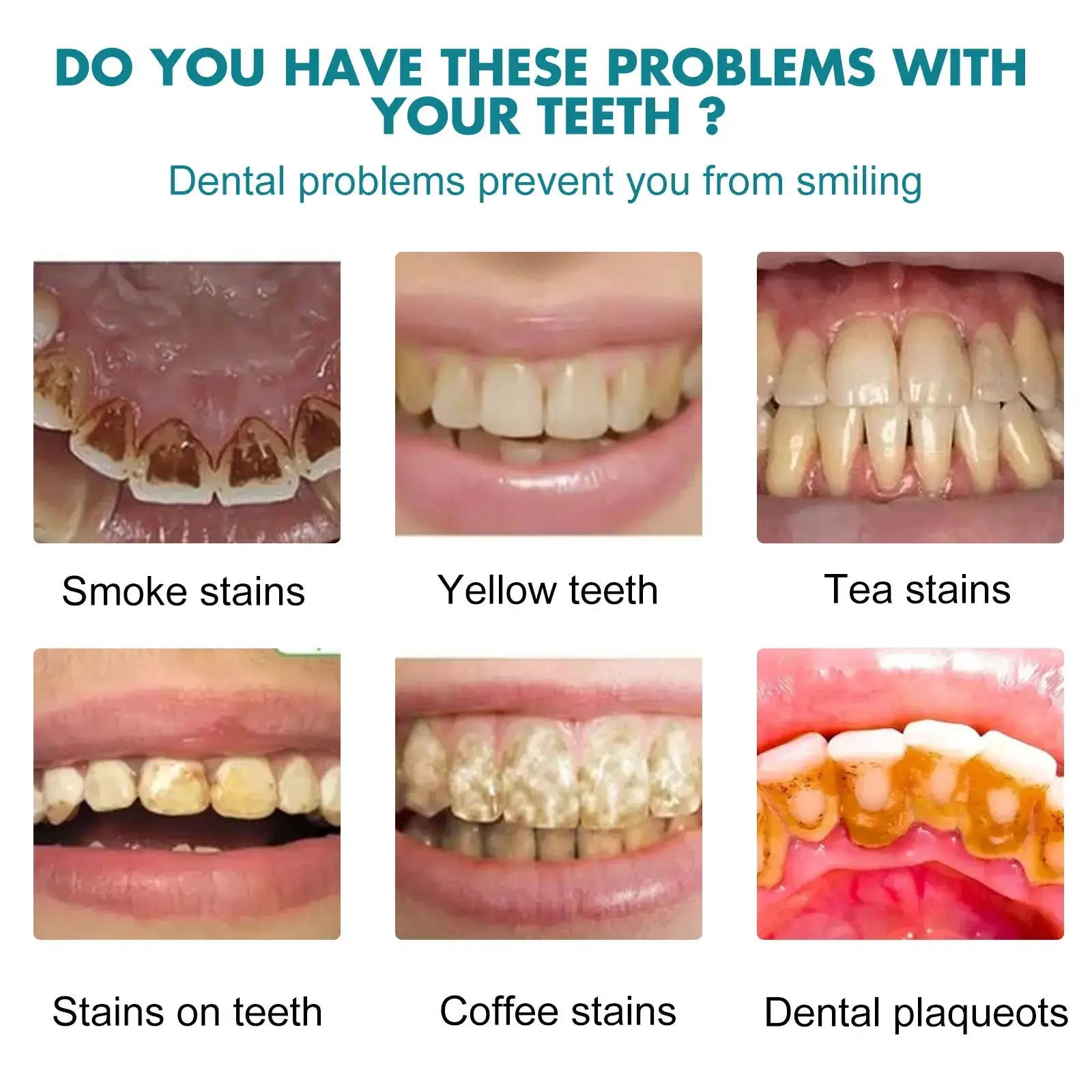 Teeth White Paint by Simples Market, whitening product for treating various stains and plaque on teeth.